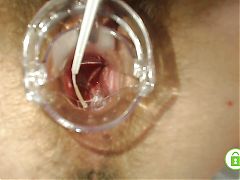 Gyno exam with speculum close up in hairy pussy